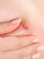 Met Art - Apakah - Andere A